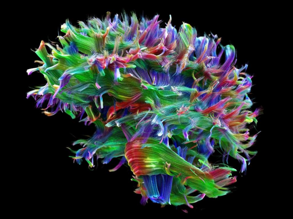 Neuroscience moves closer to understanding brain development